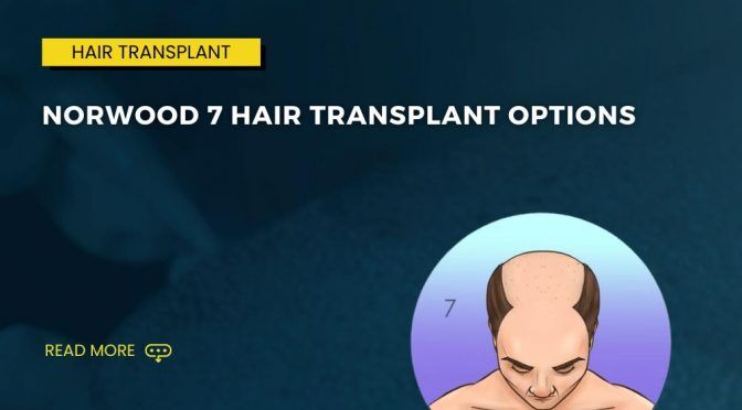 Norwood 7 Hair Transplant Options