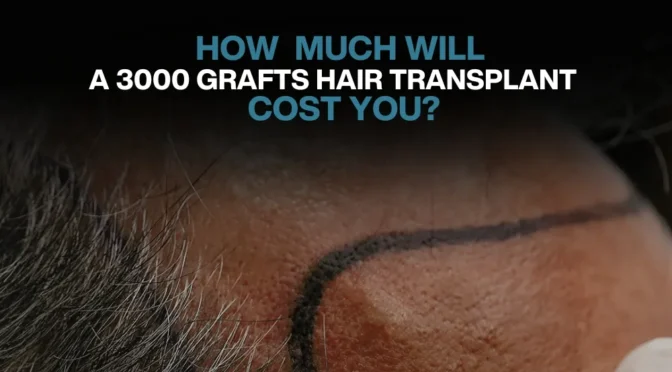 Copy of Hair transplant for Women 24