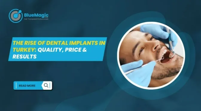 The Rise of Dental Implants in Turkey Quality, Price & Results