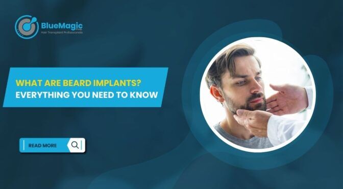 What Are Beard Implants Everything You Need to Know