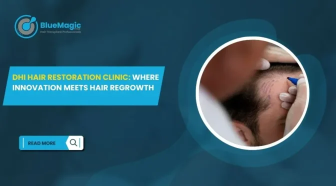 DHI Hair Restoration Clinic Where Innovation Meets Hair Regrowth