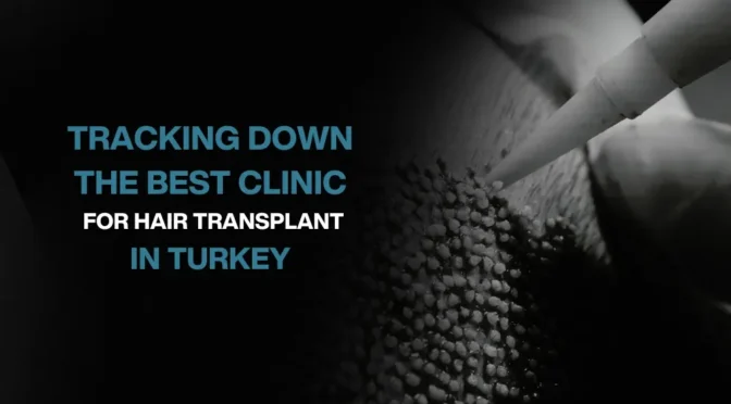 Copy of Hair transplant for Women 10